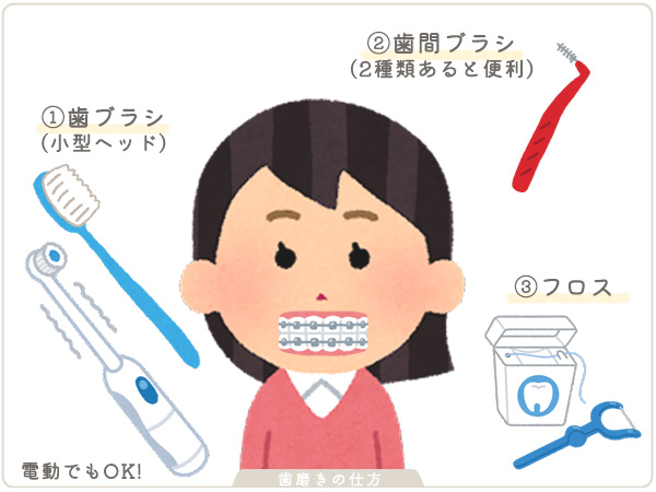 歯列矯正中の歯磨きの仕方1